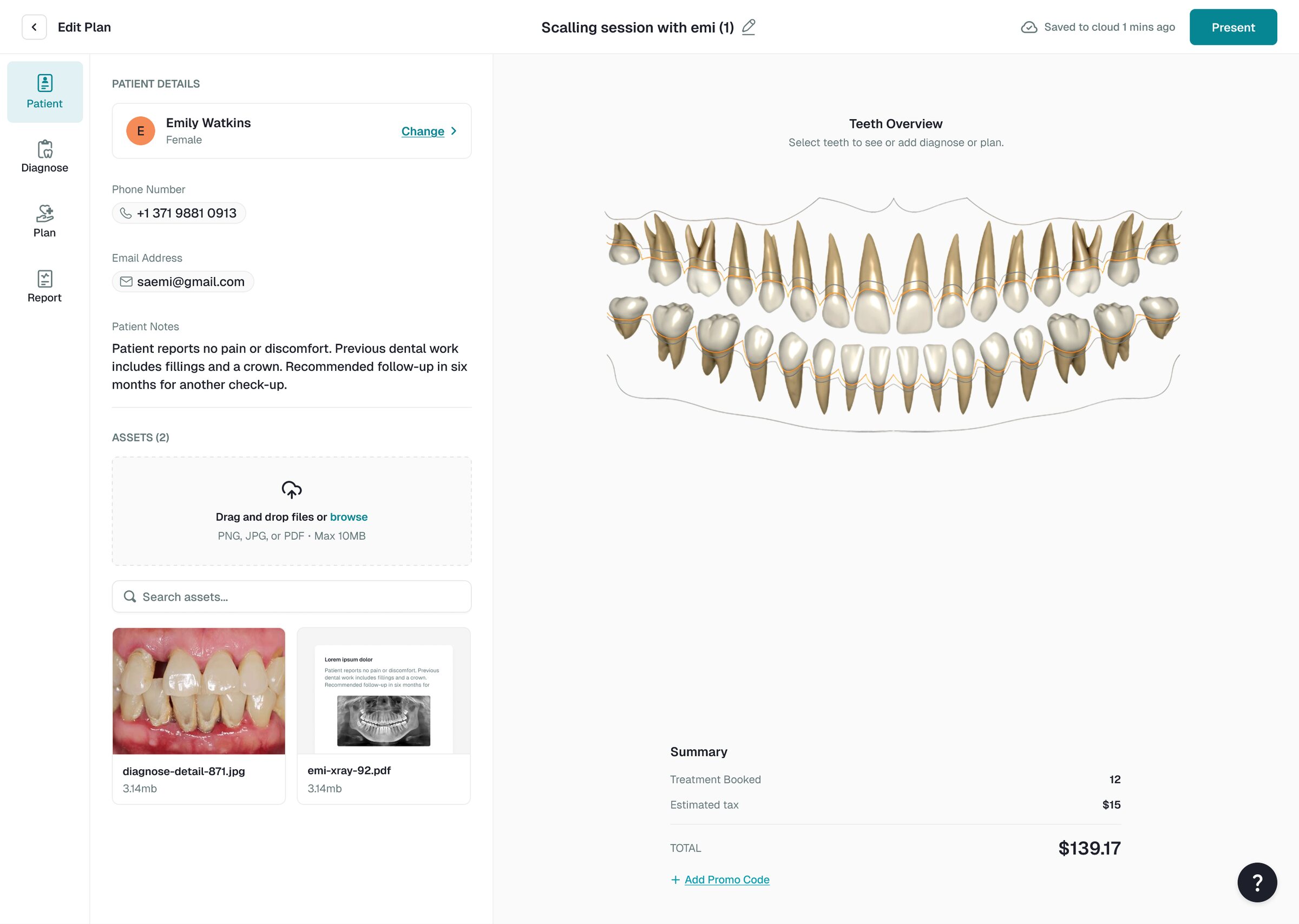 Make Me Clear plan editor with the patient's details, photos and X-rays, the teeth overview and the plan total